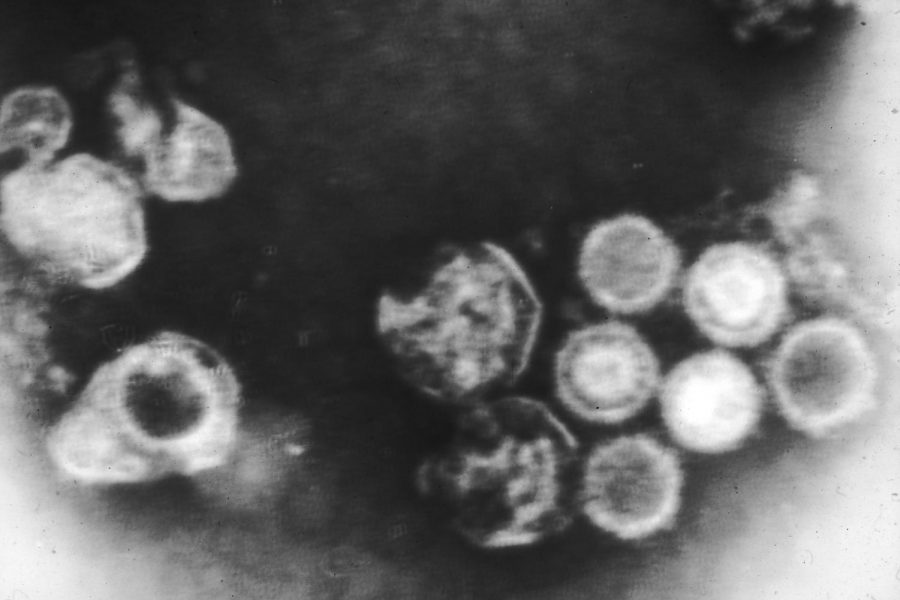 Adults who have previously been exposed to the Epstein-Barr virus, even without getting mono, can build enough antibodies to become immune to mono according to Mayo Clinic. Pictured: the Epstein-Barr virus, under a microscope.